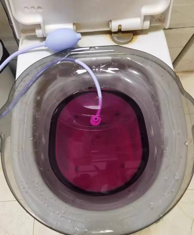 痔疮患者一般情况之下都可以选择进行保守治疗,建议使用高锰酸钾坐浴