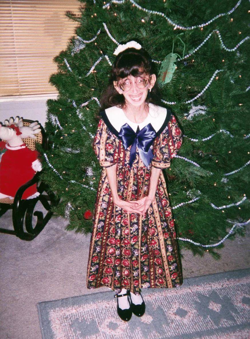 被说"全世界最丑的女人",17岁遭遇网暴,她的做法