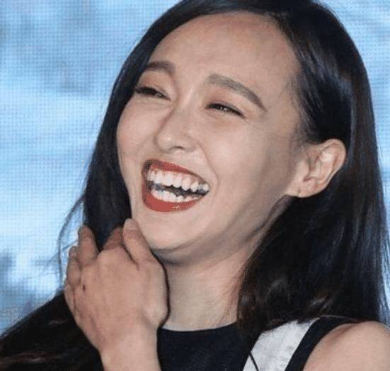 比"牙黄"更可怕的是"牙龈外露",一笑就破功,很多明星都中招_牙齿_嘴唇