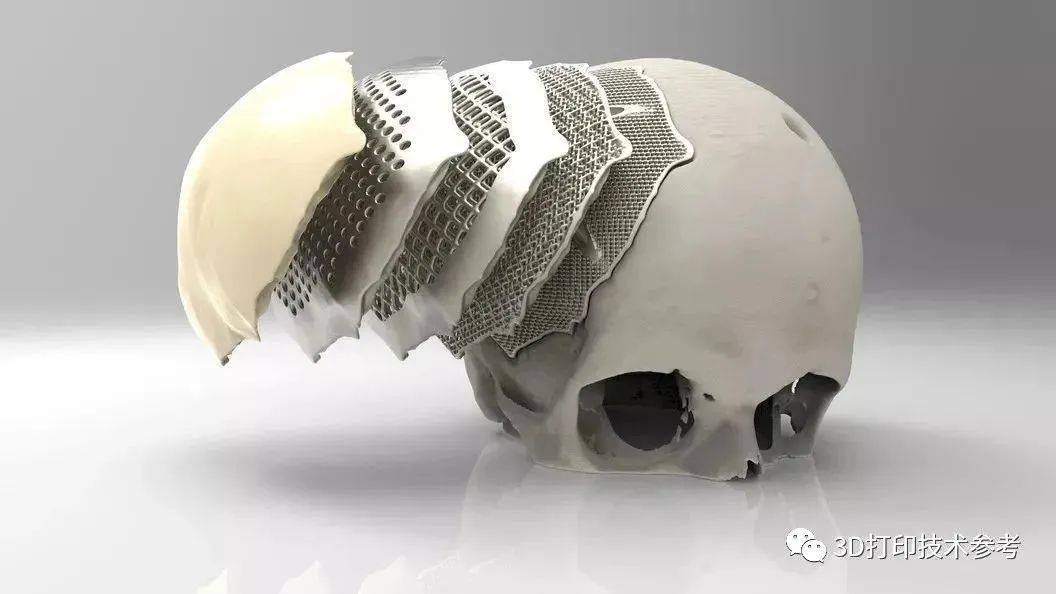 性能,可有效避免由于磨损颗粒引发的植入体周围炎症和骨溶解等问题