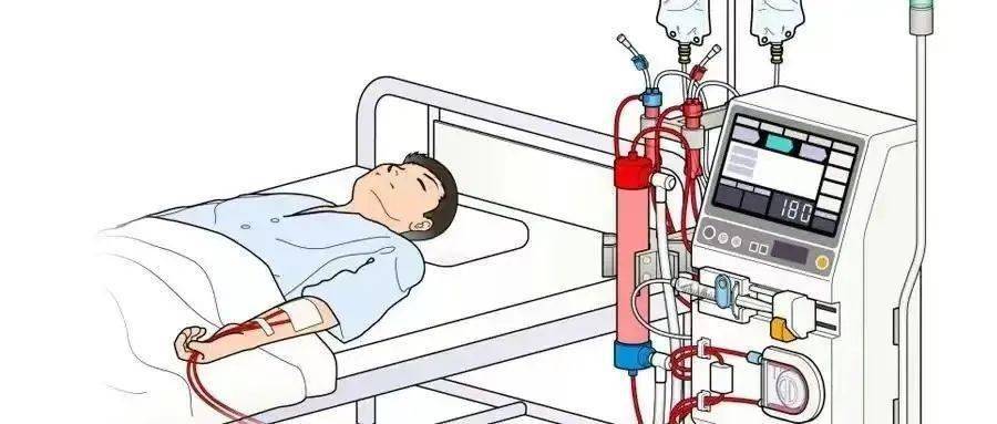 是这个样子的看到过做血液透析的患者也许大家在生活中或者影视剧里一