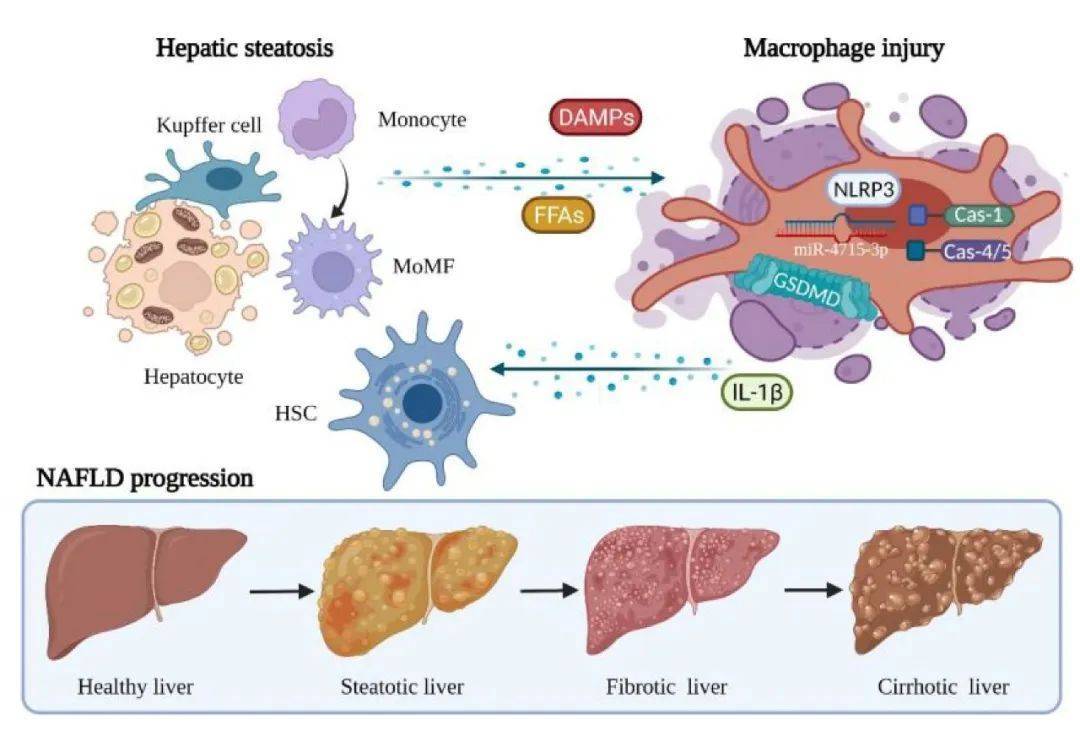 大咖盤點|賈繼東:肝纖維化發生機制及潛在治療靶點_肝臟_細胞_進展
