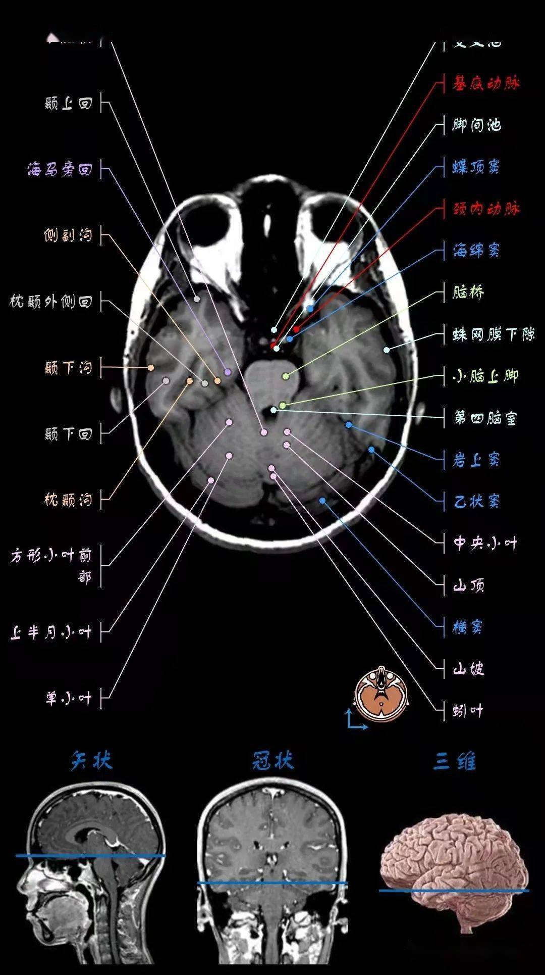 神经影像解剖系列