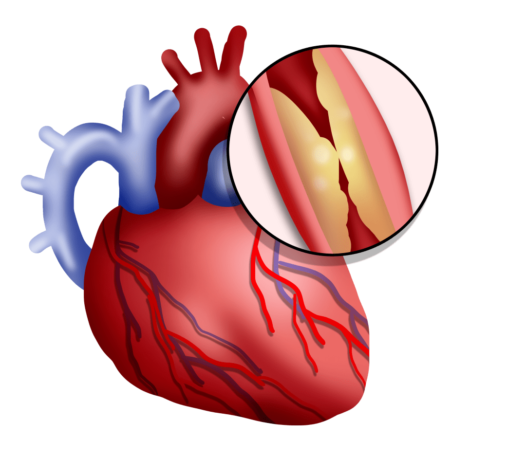 心血管_症状_永根