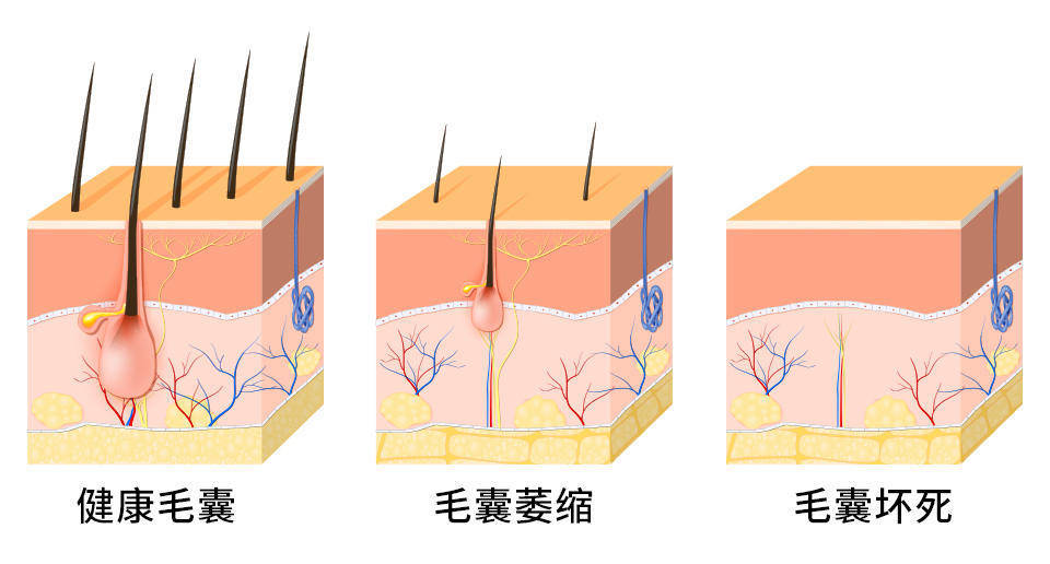 这几种情况下很难长出