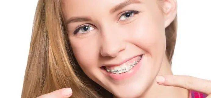 较大的人群隐形无牙套是最新的一种矫治器,也是目前最受明星青睐的,不