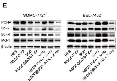 Western Blot 原理及基础应用详解剖析_Bcl_蛋白质_检测