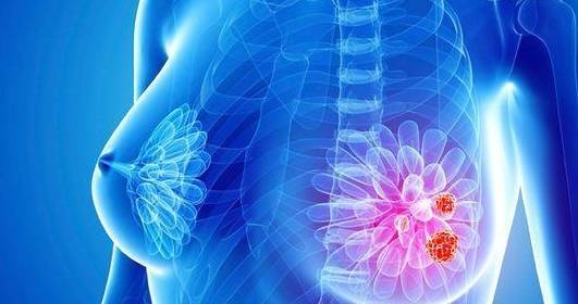 乳腺增生一般会出现哪些症状?_姑娘_月经_肿块