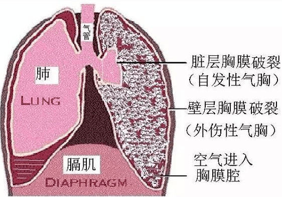 胸隔膜位置图图片