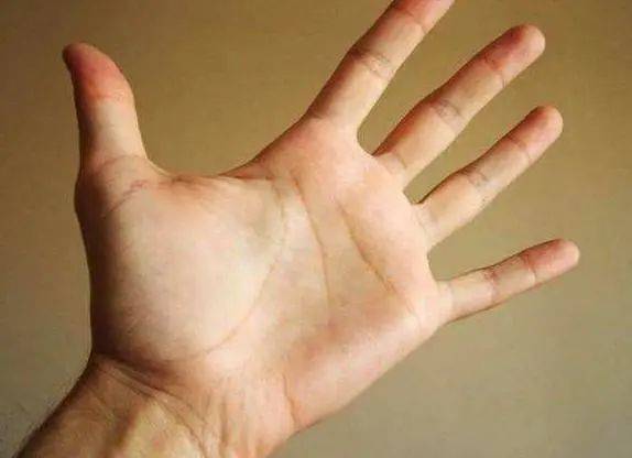 1,手掌出现褐斑第一处:颜色异常胃病大多是"拖"出来的,身体出现2个