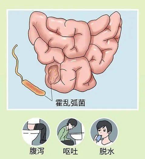 霍乱是什么 搜狐网