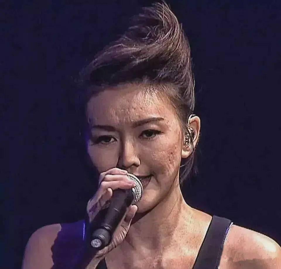 孙燕姿皮肤真这么差吗?近距离看脸上都是痘坑,有点不敢相信啊!