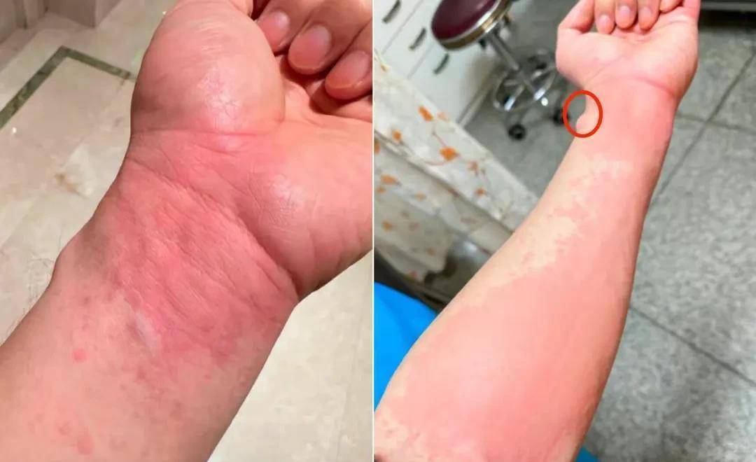 他确实吃了不少美食,烤海肠,野混沌,白花蛇草水……#闪闪发光的他