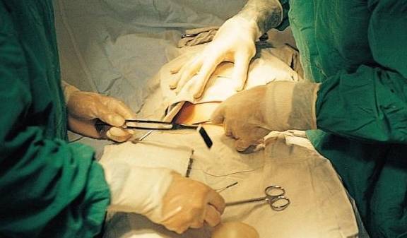 剖腹产的3大后遗症,生完孩子后并不会立马出现,二胎时会很明显_女性