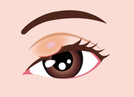 孩子眼皮容易长"疙瘩"?不一定都是麦粒肿!_眼睑_肿瘤_症状