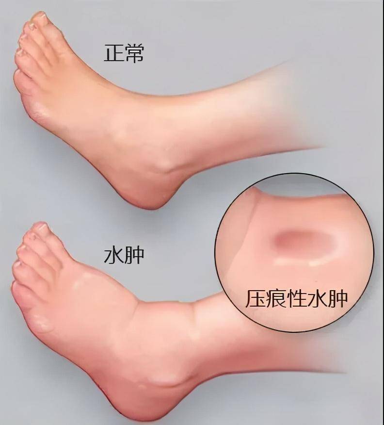 小腿_肌肉_运动