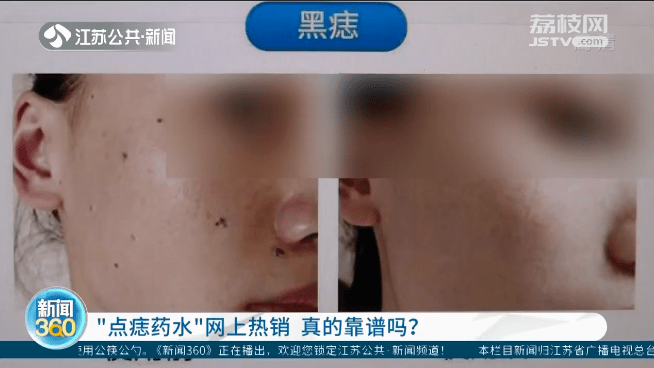 这种药水热卖 医生 或有癌变风险 皮肤 产品 卖家