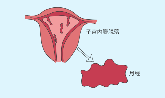 月经就是子宫内膜的血管迂曲,充盈,最后破裂导致子宫内膜脱落,出血