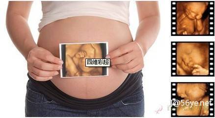 什么是四维彩超EFW？测胎儿体重准吗？