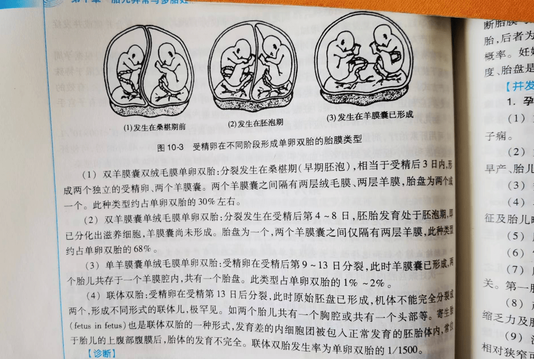 22年前浙江首例连体婴分离手术的存活者现在过得怎么样了(连体婴儿是怎么产生