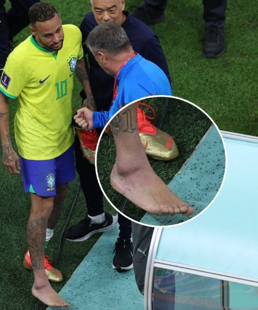 巴西队担忧！内马尔右脚肿胀瘀血 相信他会继续踢这届世界杯