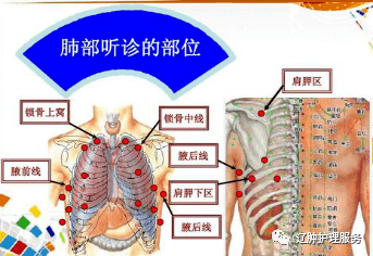 扣背排痰你真的達到效果了嗎?_患者_護理_肺部