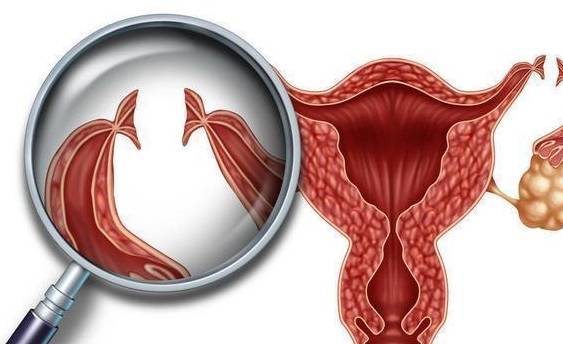 卵巢癌"上门",或许身体会有这5个"信号",早看早知!_检查_情况_病人