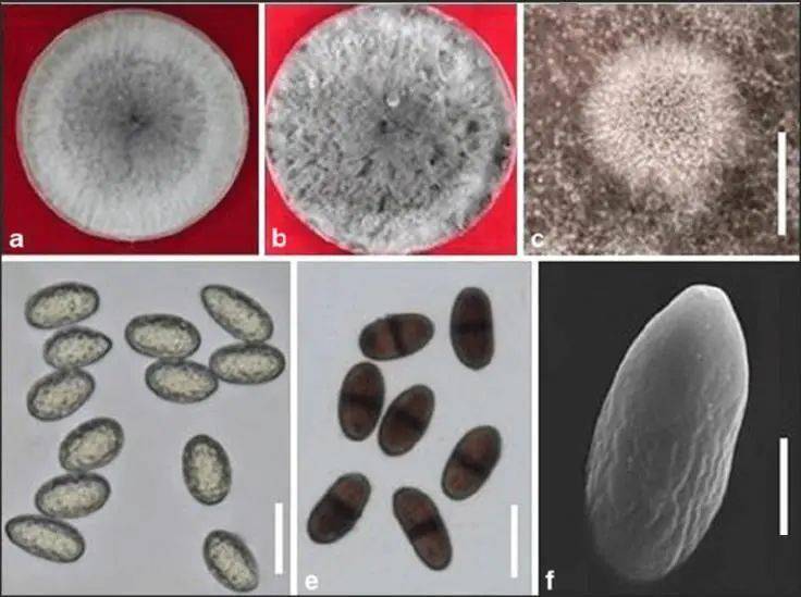 可可毛色二孢菌 lasiodiplodia theobromae新菠萝灰粉蚧 dysmicoccus