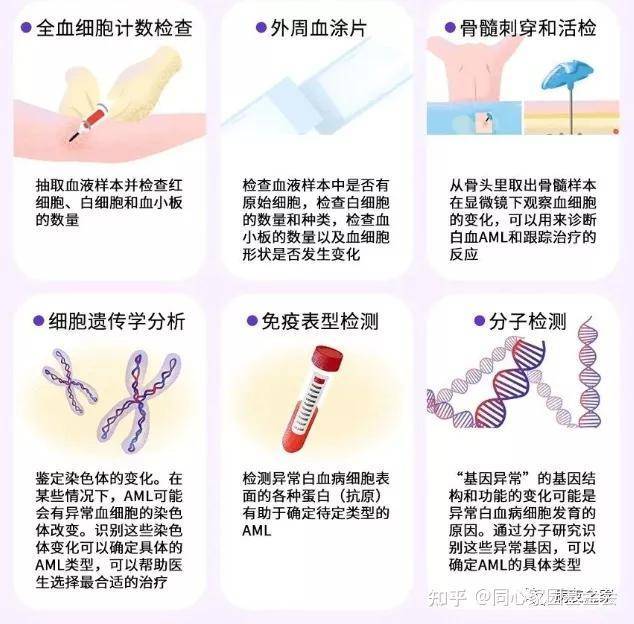 aml需要做的检查主要有血常规(全血细胞计数),外周血涂片,骨髓检查