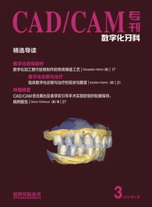 【精选案例】CAD/CAM愈合基台及美学区引导手术实现软组织轮廓保存：病例报告（美）_种植_牙龈