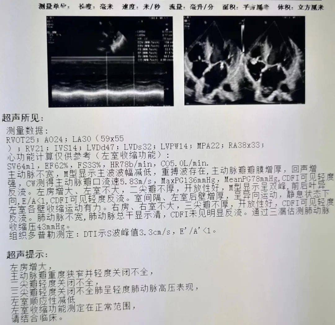 冠脉ct报告图片
