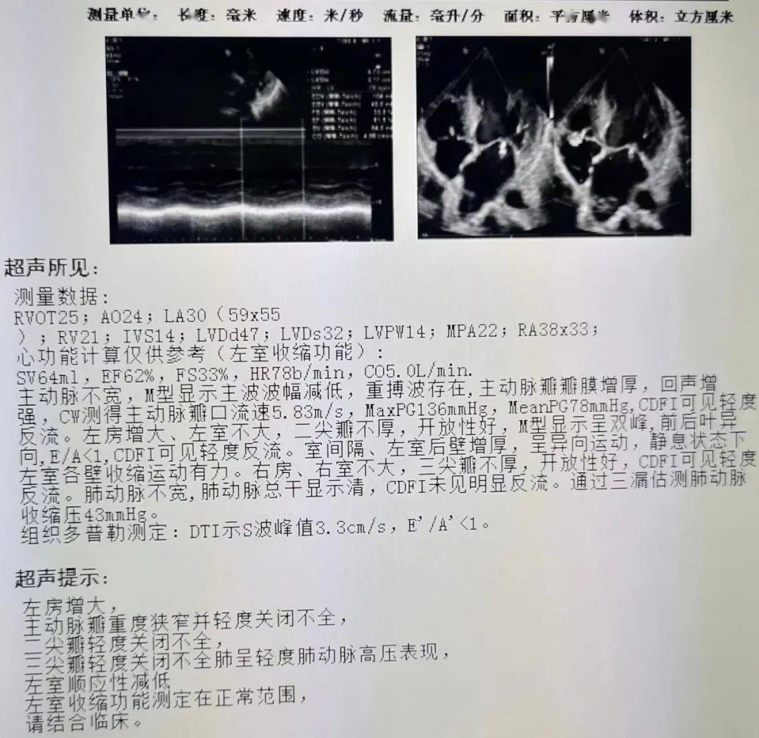 冠心病检查结果图片