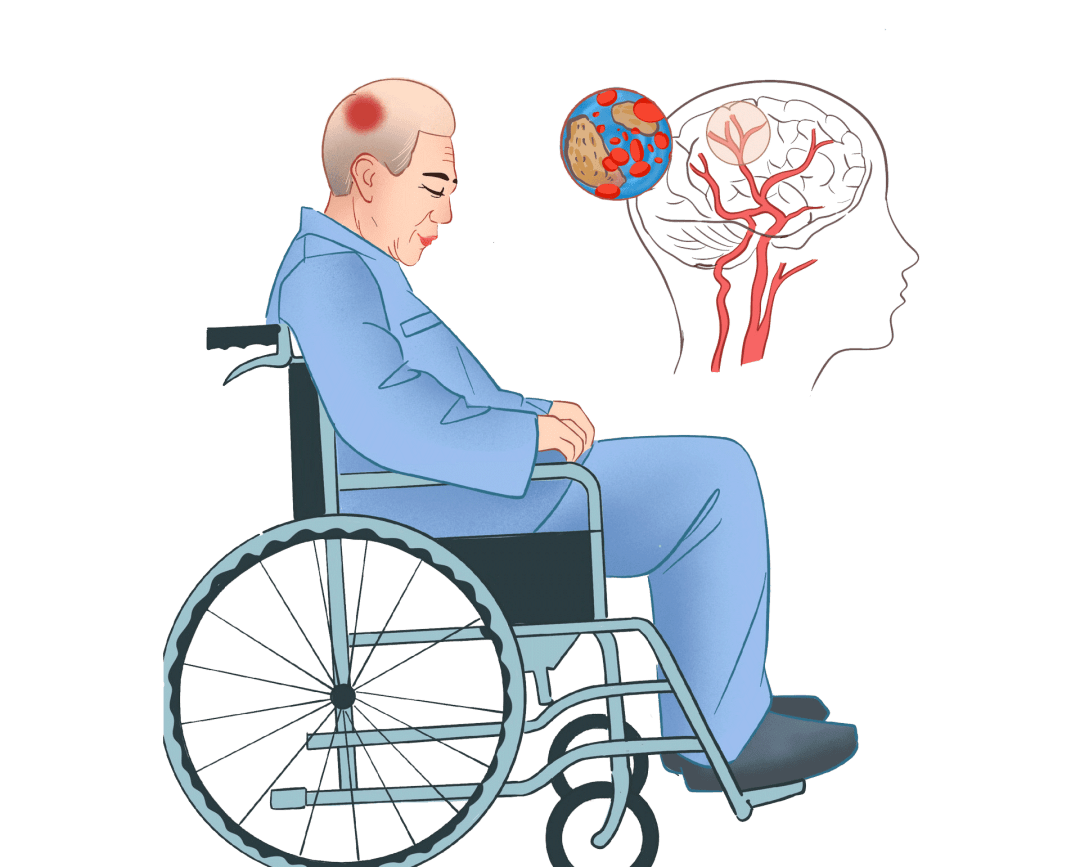 老人冬天洗澡不注意,易发生脑中风!