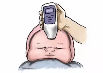 经皮测黄疸方便,快捷,准确_监测_新生儿_方法