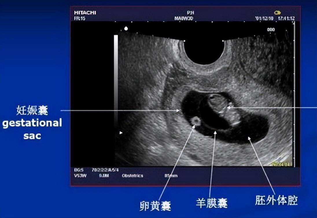 孕妇阳了错过产检怎么办？这4项产检关乎胎儿健康,提前安排好