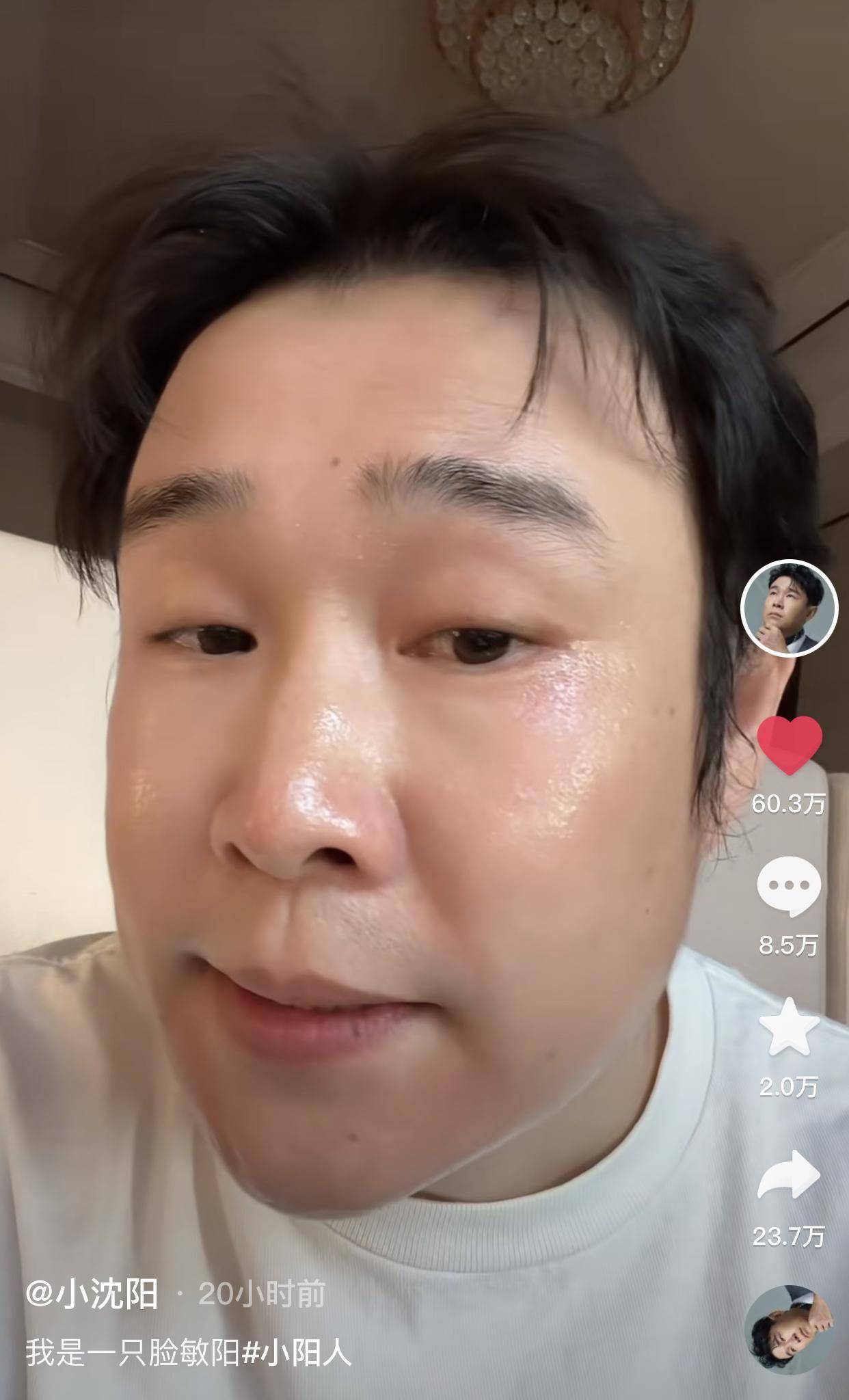 韩红感染新冠三天发型似鸡窝嗓音受损暴瘦脸小一圈尖下巴抢镜