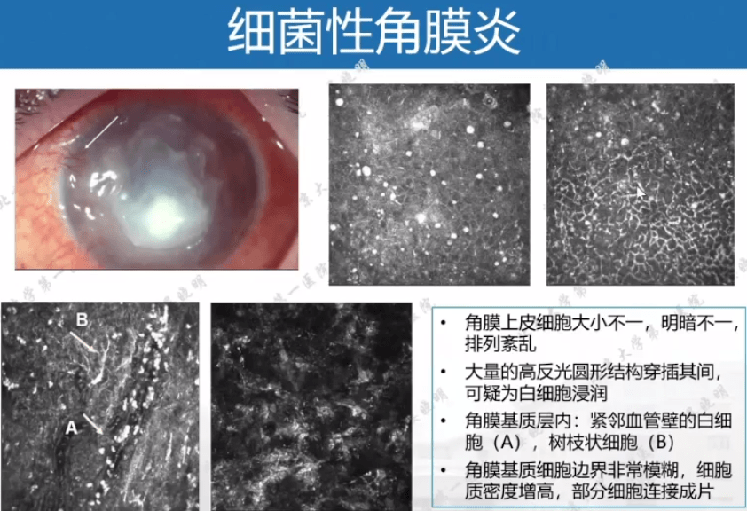 显微镜污物位置判断图片