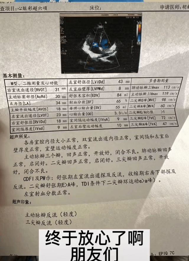 心脏超声检查报告单图片