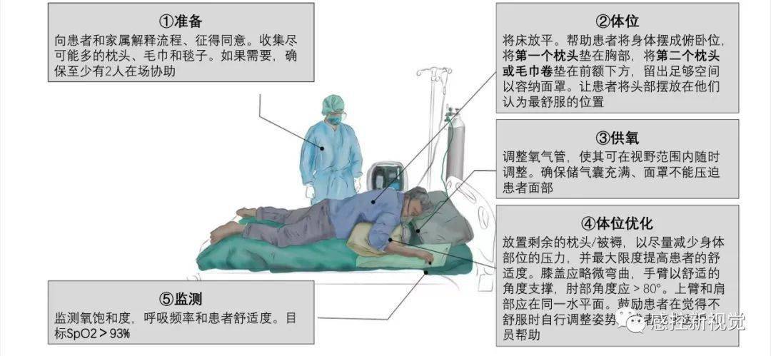 俯卧位通气原理图片图片