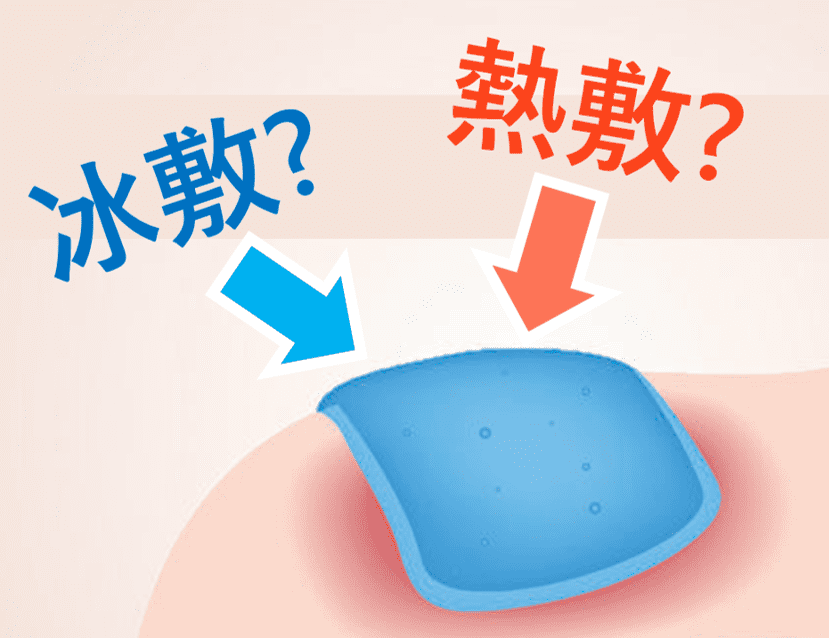 冰敷与热敷如何选？区别在哪里？_冰袋_损伤_时间