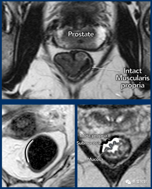 peritoneal cavity图片