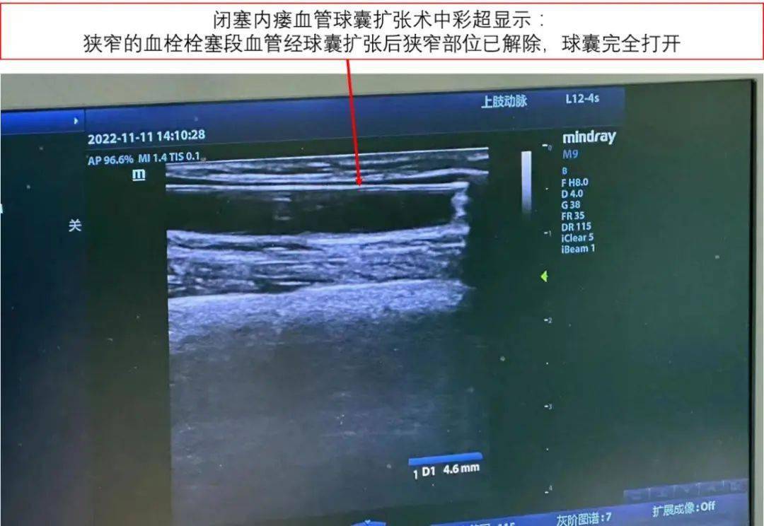 中國中醫科學院眼科醫院穿刺預約-下載中國中醫科學院眼科醫院app 