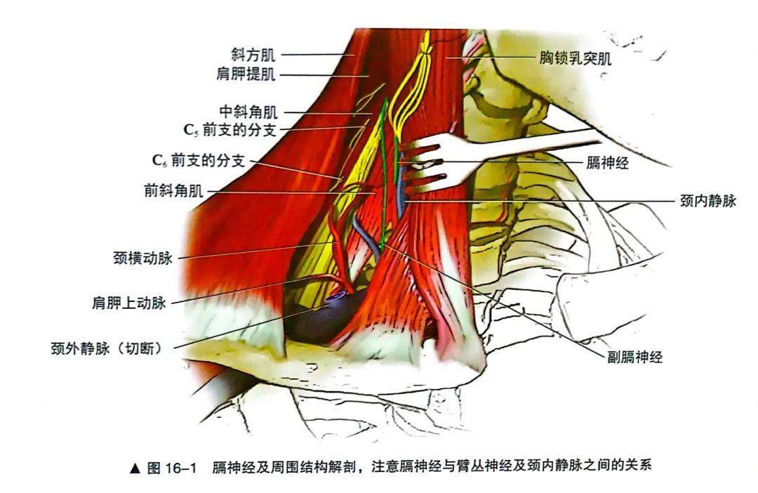 肌间沟 臂丛图片