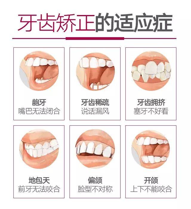 《2023年湖南省新一批看牙专项补助》正式发放！2月起实行