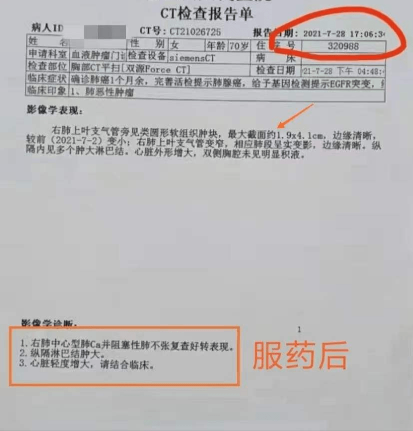 肺癌化验单图片真实图片