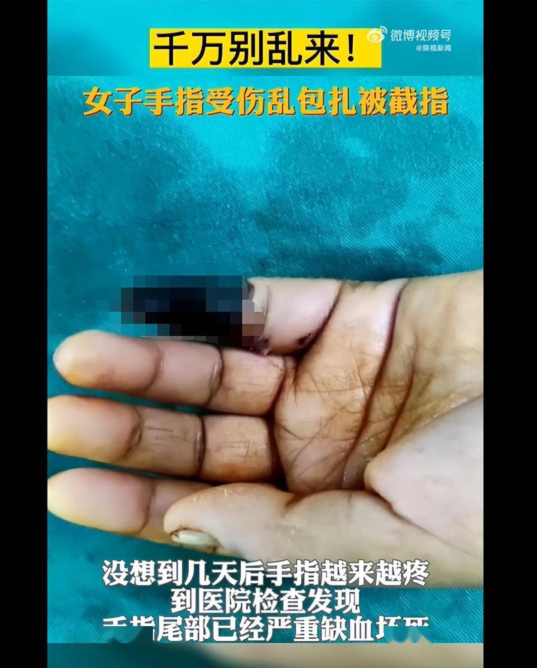 3岁女童手指坏死截肢!这个东西别再用错了,家家都有