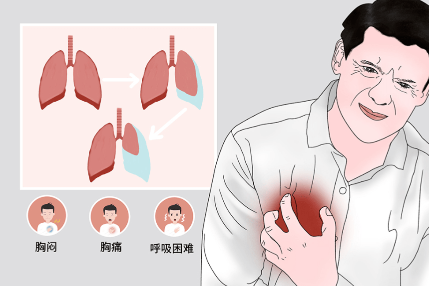 气炸肺图片