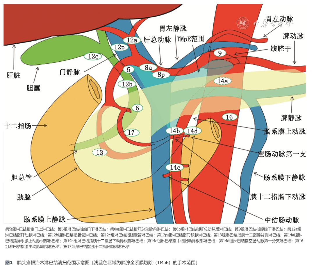 海氏三角解剖结构图片