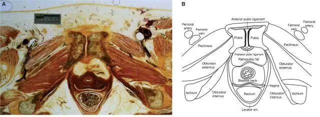 一文了解 | 恥骨聯合的解剖及影像學解析_韌帶_mm_纖維