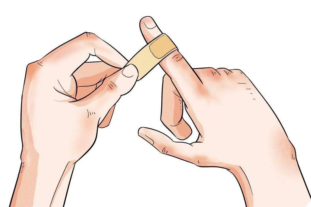 创可贴和创口贴,竟然不是同一种东西?_伤口_创面_敷料